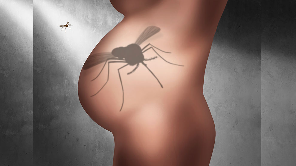 Gemelos, clave para entender cómo el zika provoca malformaciones congénitas