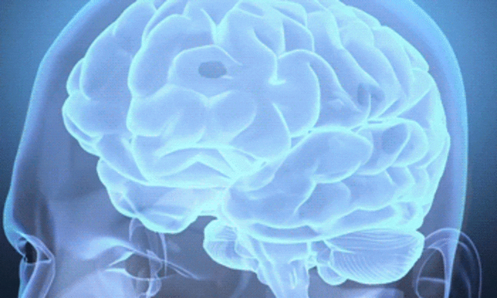 Se suma Universum a actividades de la Semana Internacional del Cerebro