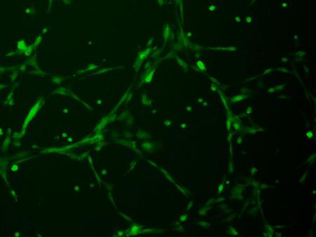 Investigadores conviertes células madre en vasos sanguíneos, para tratar un tipo de ceguera rara