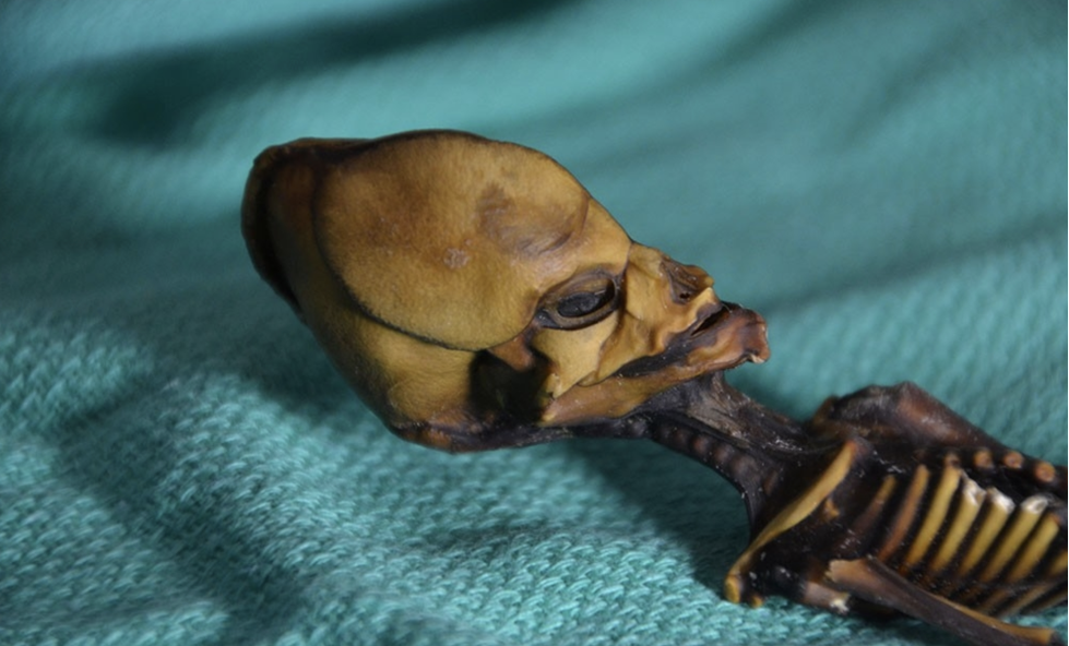 Misterioso esqueleto muestra complejidad molecular de enfermedades óseas