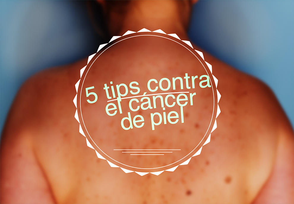 Cinco cosas que no sabías que te pueden salvar del cáncer de piel