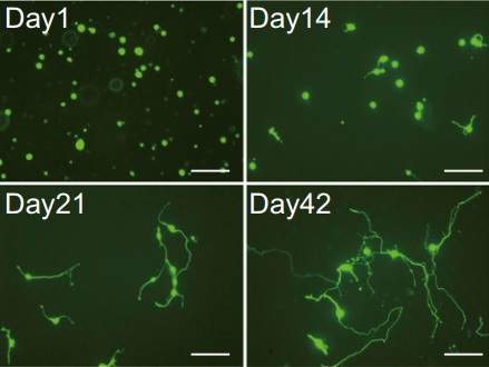 Las células sanguíneas pueden ser convertidas en neuronas funcionales