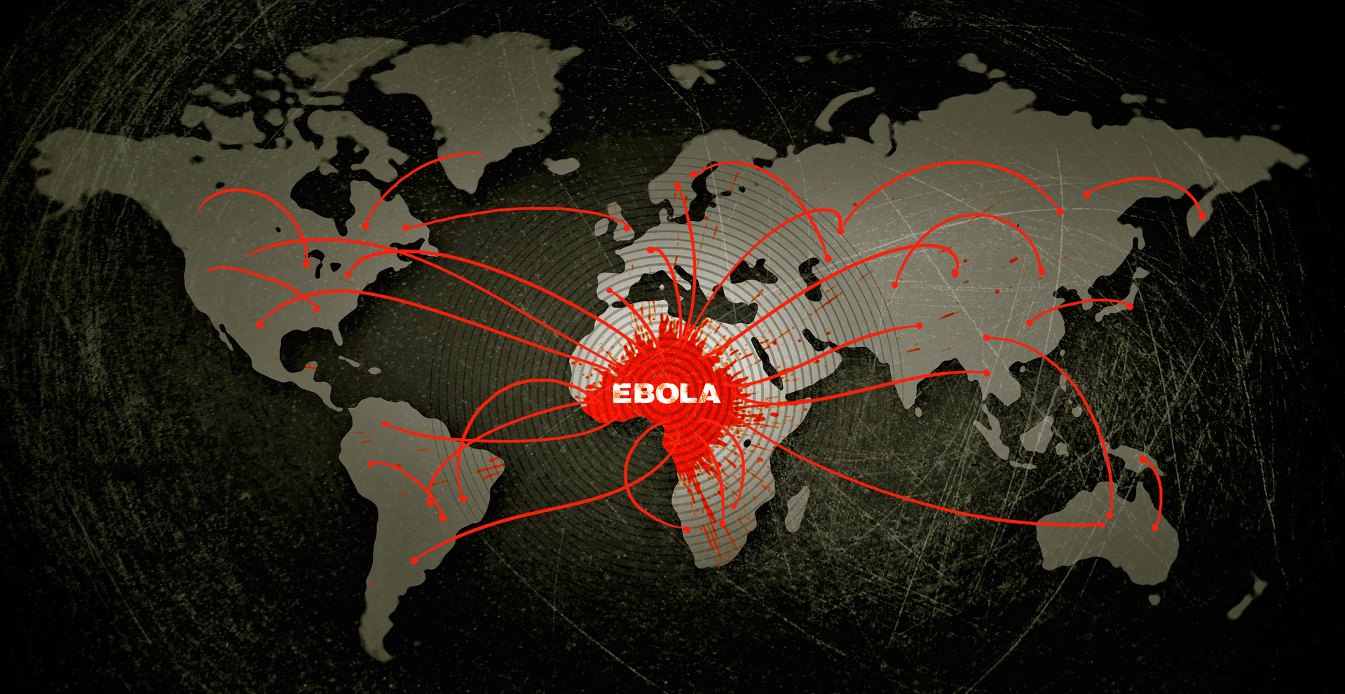 Ébola en la RD Congo, una emergencia de salud pública de interés internacional