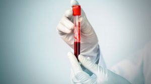 mínima-muestra-sangre-detecta-daño-renal-UNAMGlobal