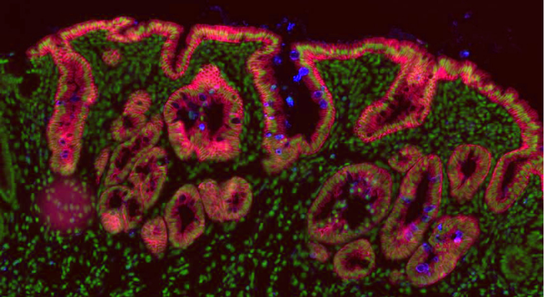 Sorprendente hallazgo: Todas las células inmaduras pueden convertirse en células madre