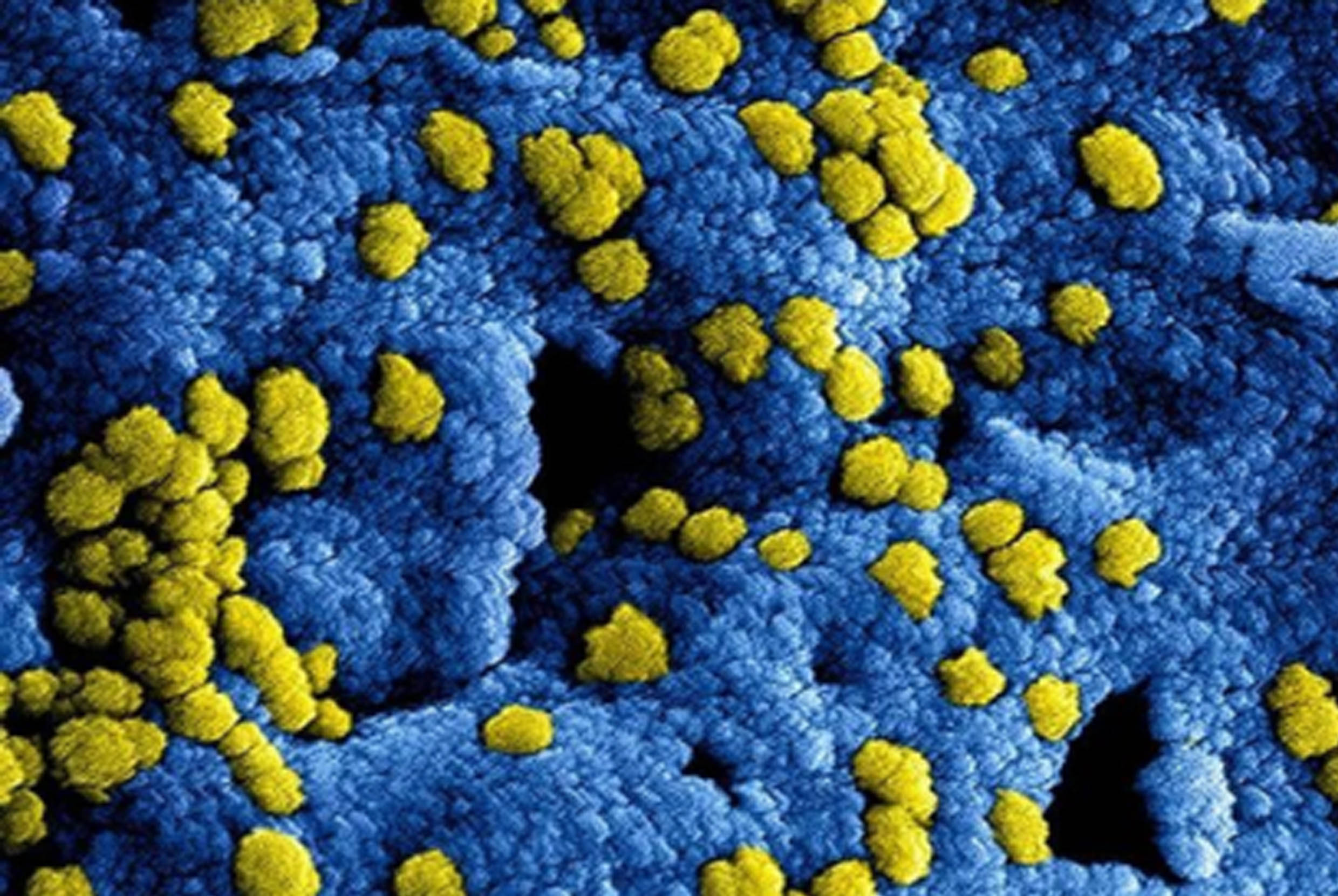 Retransmisión: Coronavirus de Wuhan ¿qué sabemos hasta ahora?