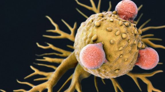 Descubren una nueva célula inmune que podría ser útil para desarrollar una nueva terapia contra todo tipo de cáncer