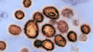 Imagen de microscopio electrónico del virus que causa laenfermedad por coronvirus 2019