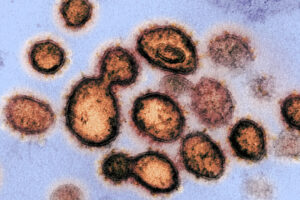 Imagen de microscopio electrónico del virus que causa laenfermedad por coronvirus 2019