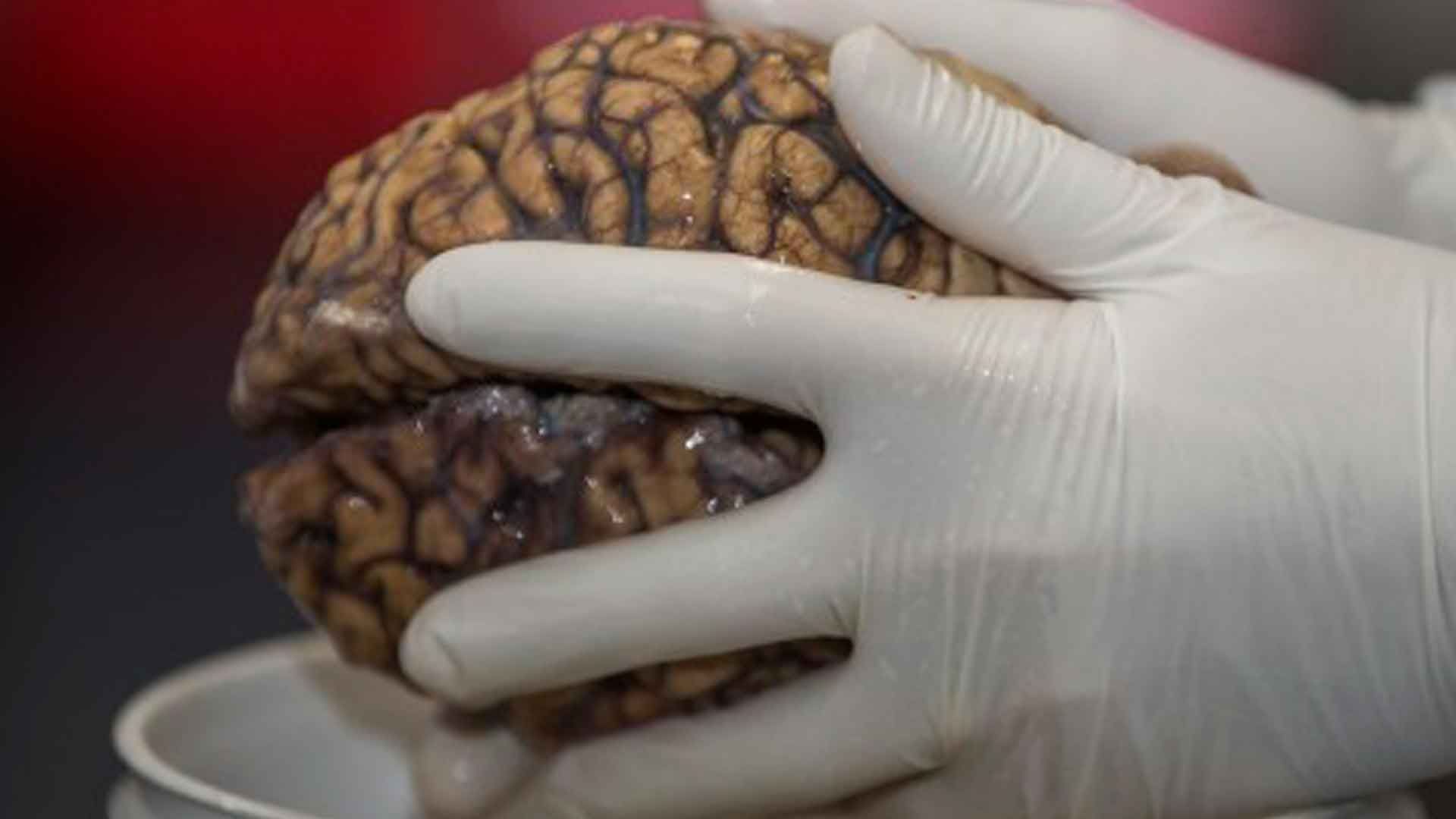 UNAM crea Biobanco de cerebros para estudiar enfermedades neurodegenerativas