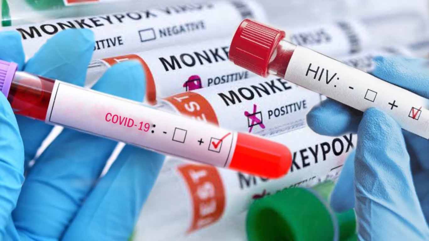 Da positivo a COVID, viruela del mono y VIH