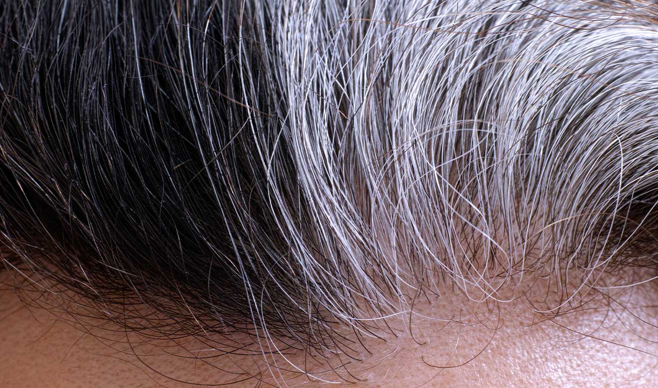 ¿Por qué salen canas?