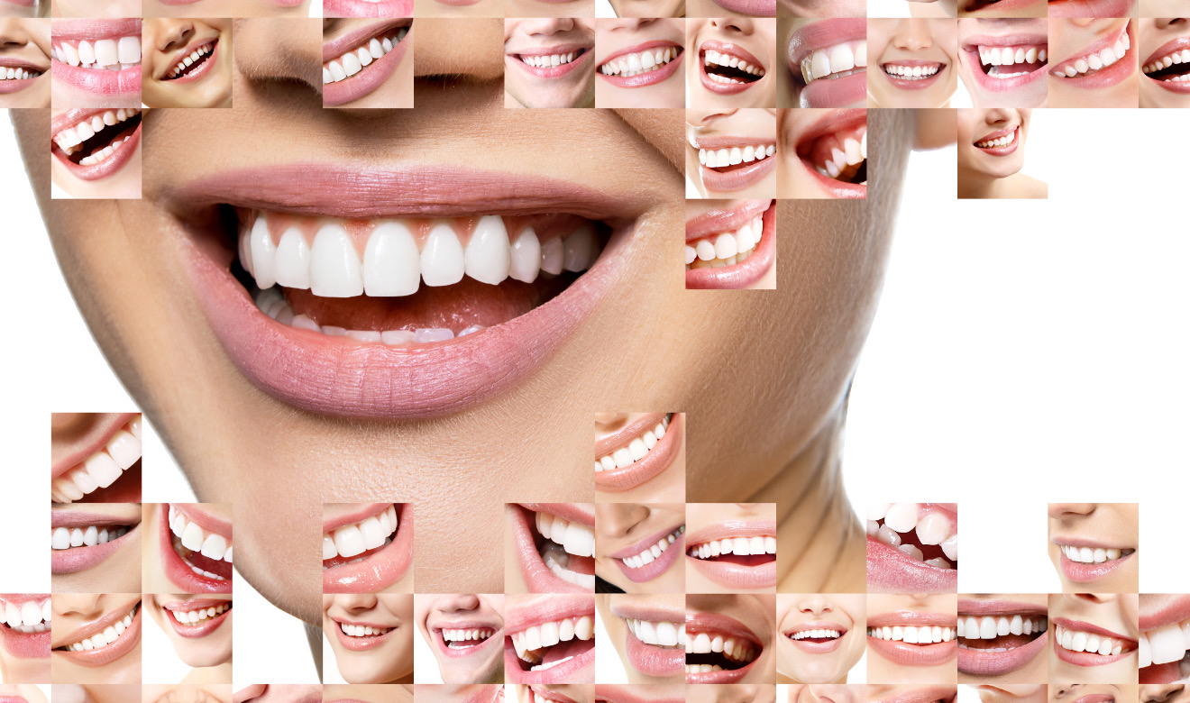Blanqueamiento dental: tan malo como echarle ácido a la cañería