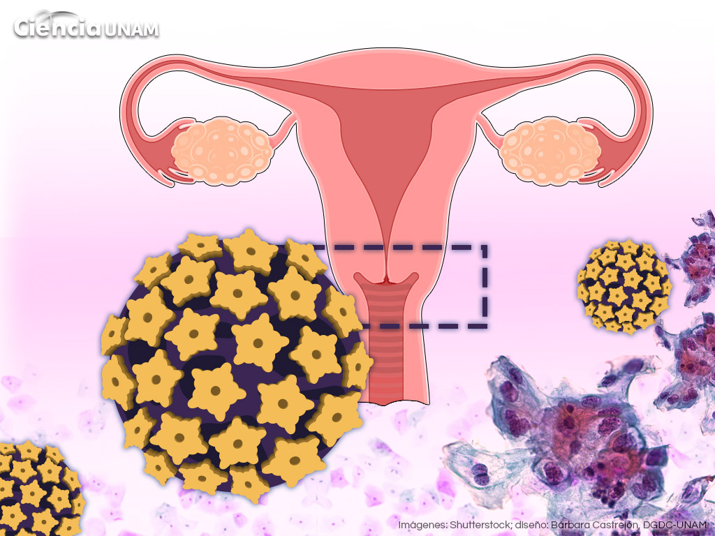 Aumento de cáncer cérvico uterino en jóvenes