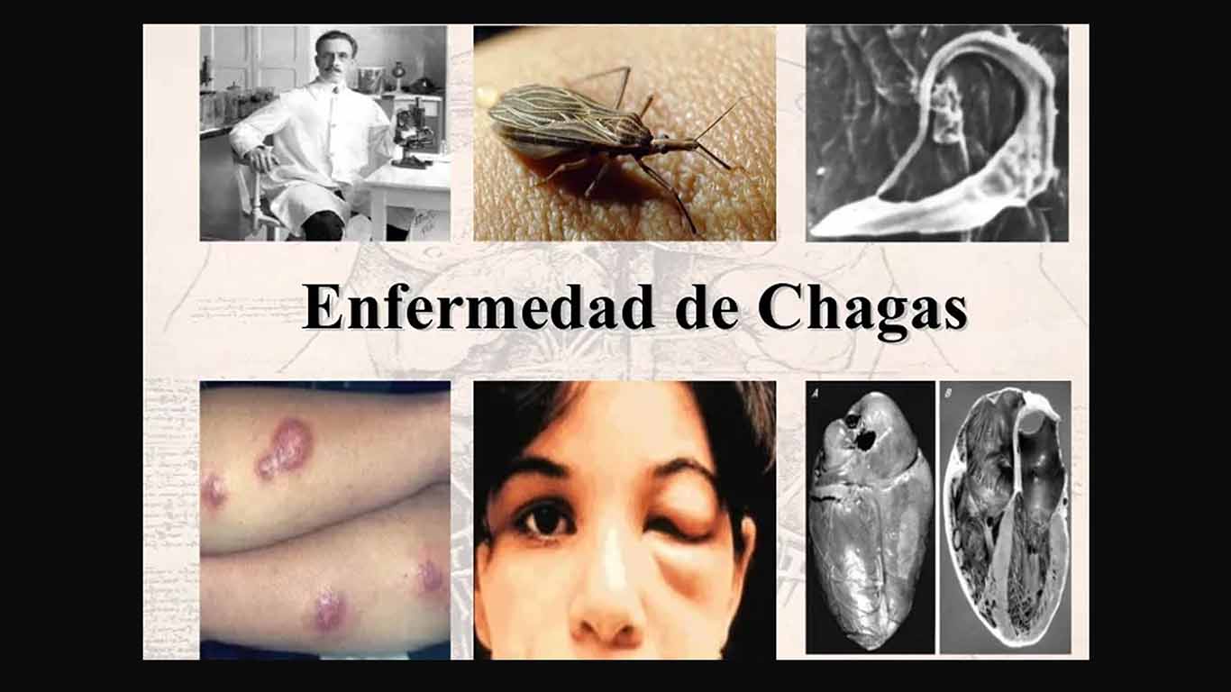 Podría provocar muerte súbita la Enfermedad de Chagas