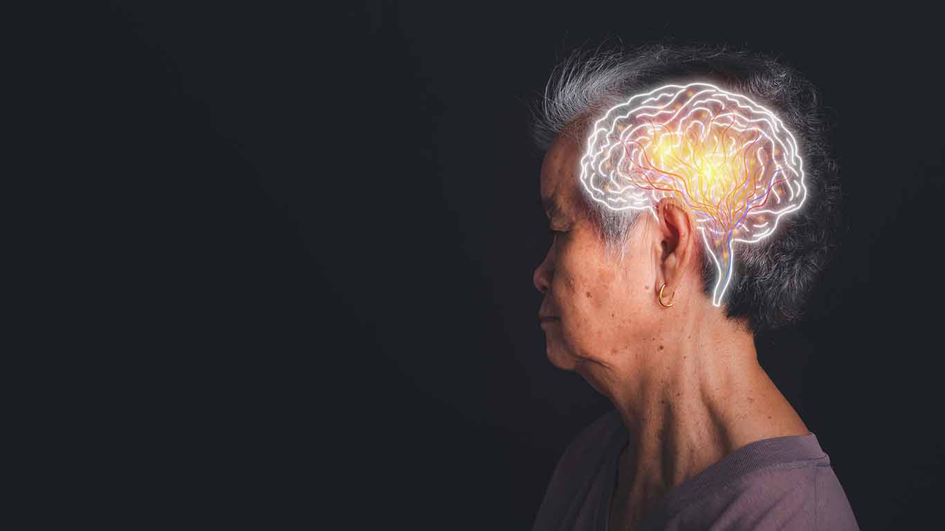Parkinson: una enfermedad degenerativa del cerebro